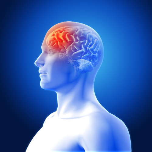 Brain Stroke
