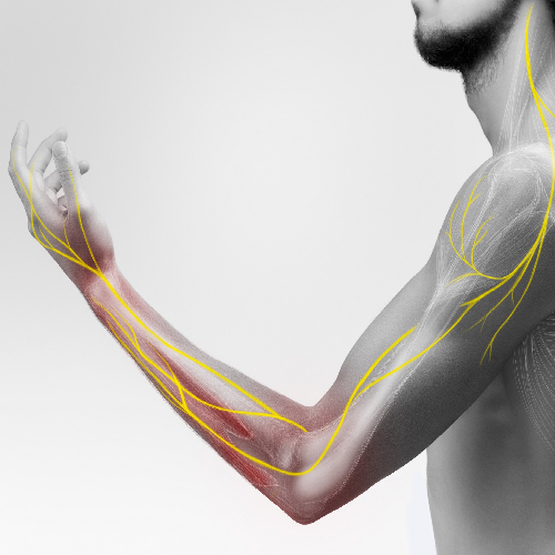 Nerve & Muscle Disorders